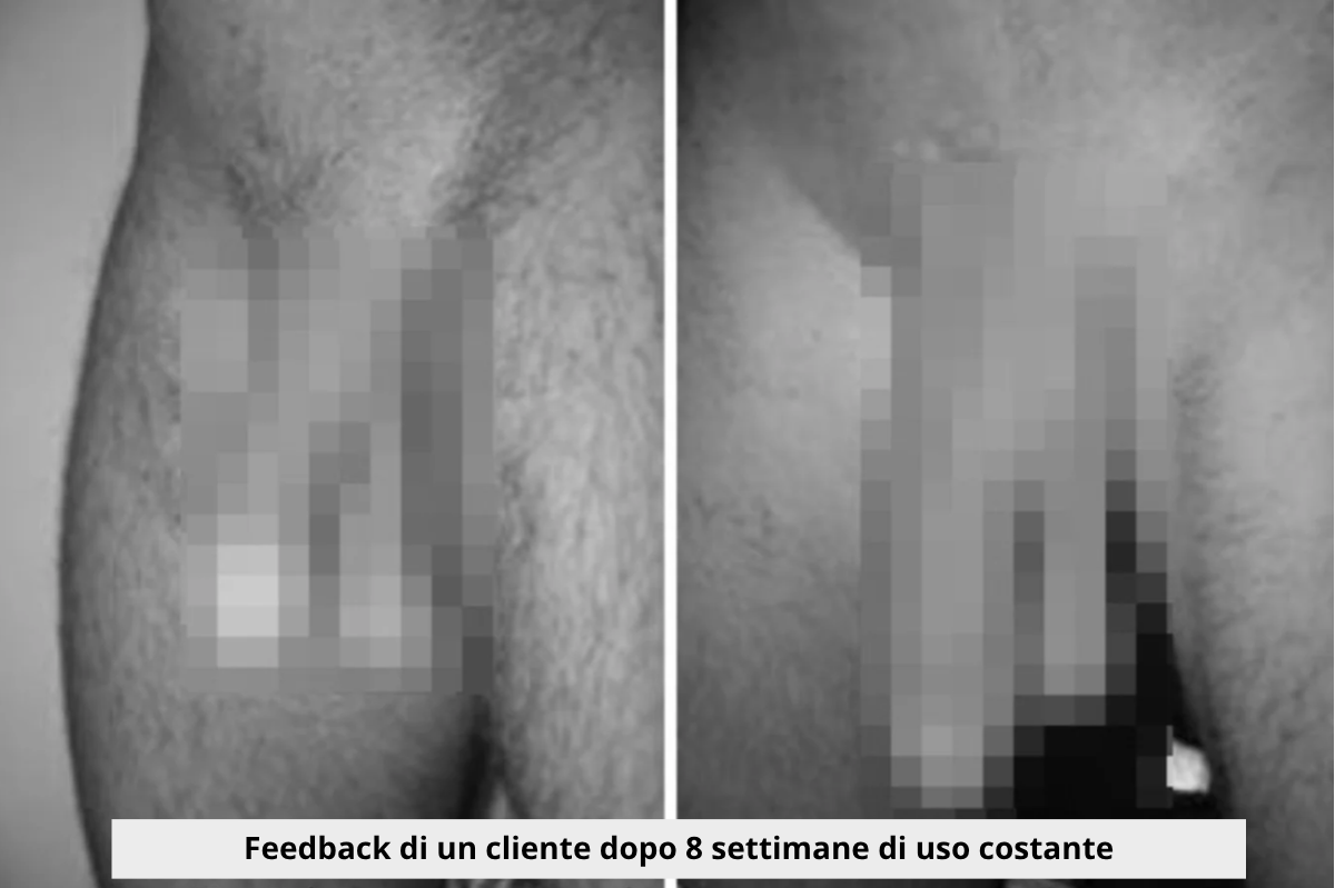 Meccanismo Wave Therapy Pro